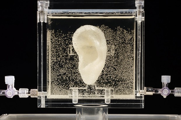 ゴッホの切捨てられた耳がヒト細胞を使って3D印刷されました。