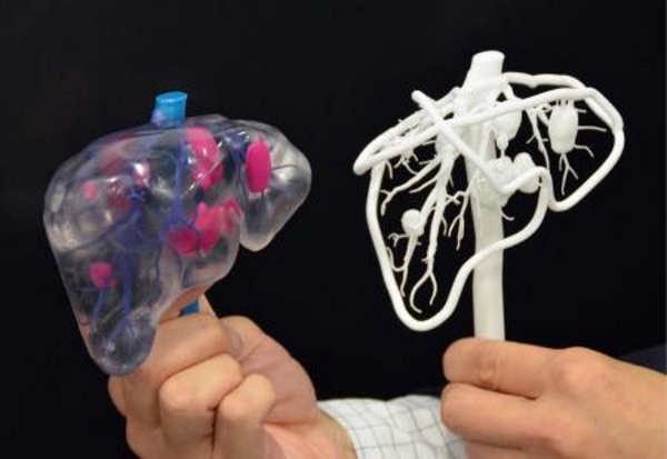 手術シミュレーションのための3Dプリント樹脂内臓を日本が発表
