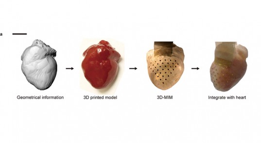 次世代心臓ペースメーカーの作成過程に、3Dプリンターモデルを利用